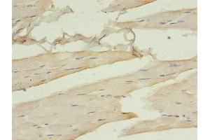 Immunohistochemistry of paraffin-embedded human skeletal muscle tissue using ABIN7161378 at dilution of 1:100 (Doublecortin antibody  (AA 108-360))