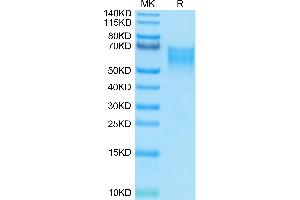 Biotinylated Human B7-2 on Tris-Bis PAGE under reduced condition. (CD86 Protein (CD86) (His-Avi Tag,Biotin))