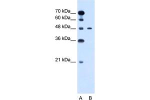 Western Blotting (WB) image for anti-Pre-B-Cell Leukemia Homeobox Protein 1 (PBX1) antibody (ABIN2460192) (PBX1 antibody)