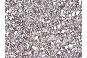 Image no. 9 for anti-CNDP Dipeptidase 2 (Metallopeptidase M20 Family) (CNDP2) antibody (ABIN1497548) (CNDP2 antibody)