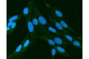 IF analysis of Kindlin 2/FERMT2 using anti-Kindlin 2/FERMT2 antibody (ABIN7599515). (FERMT2 antibody  (AA 1-650))