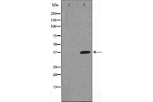 Western blot analysis of I kappaB alpha phosphorylation expression in COS7 whole cell lysates,The lane on the left is treated with the antigen-specific peptide. (NFKBIA antibody  (pSer32, pSer36))