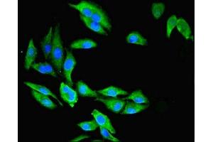 Immunofluorescent analysis of Hela cells using ABIN7146755 at dilution of 1:100 and Alexa Fluor 488-congugated AffiniPure Goat Anti-Rabbit IgG(H+L) (CMBL antibody  (AA 2-245))