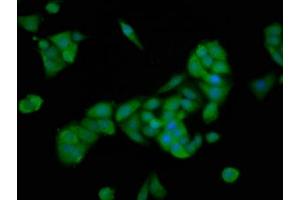 Immunofluorescence staining of PC-3 cells with ABIN7168748 at 1:166, counter-stained with DAPI. (PTTG2 antibody  (AA 1-202))