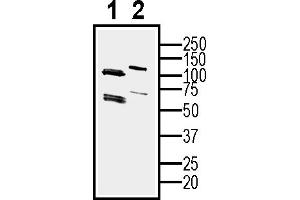 Western blot analysis of human  MG glioblastoma cell line lysate (lane 1) and  MG-derived purified exosomes (lane 2)50 μg of cells and purified exosomes lysates were analyzed using Anti-CD81 (extracellular) Antibody (ABIN7581847), (1:400). (CD81 antibody  (Extracellular))