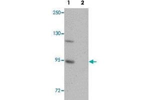 Western blot analysis of mouse brain tissue with ZC3H12B polyclonal antibody  at 1 ug/mL in (Lane 1) the absence and (Lane 2) the presence of blocking peptide . (ZC3H12B antibody  (N-Term))