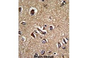 Immunohistochemistry (IHC) image for anti-Serine/threonine Kinase Receptor Associated Protein (STRAP) antibody (ABIN3001728) (STRAP antibody)
