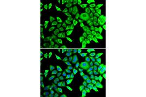 Immunofluorescence analysis of A549 cells using THADA antibody (ABIN5974287). (THADA antibody)