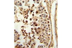 Formalin-fixed and paraffin-embedded human testis tissue reacted with PPP3R2 / CBLP Antibody (N-term) followed which was peroxidase-conjugated to the secondary antibody, followed by DAB staining. (Calcineurin B antibody  (N-Term))