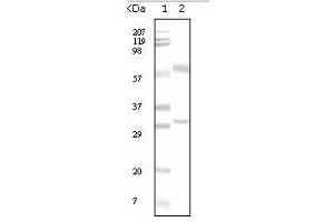 Western Blotting (WB) image for anti-Estrogen Receptor 1 (ESR1) antibody (ABIN1107144) (Estrogen Receptor alpha antibody)
