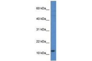 Image no. 1 for anti-Histone H2A Type 1-H (HIST1H2AH) (C-Term) antibody (ABIN6747584)