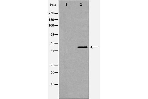 Dematin antibody  (pSer403)