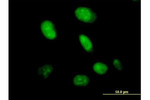 Immunofluorescence of purified MaxPab antibody to CXorf43 on HeLa cell. (HDX antibody  (AA 1-690))