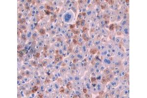Used in DAB staining on fromalin fixed paraffin- embedded liver tissue (Sonic Hedgehog antibody  (AA 28-193))