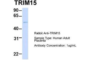 Host: Rabbit  Target Name: TRIM15  Sample Tissue: Human Adult Placenta  Antibody Dilution: 1. (TRIM15 antibody  (Middle Region))