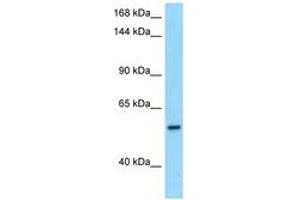 Image no. 1 for anti-phosphodiesterase 6B, CGMP-Specific, Rod, beta (PDE6B) (AA 105-154) antibody (ABIN6748131) (PDE6B antibody  (AA 105-154))