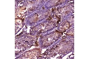 IHC analysis of Cyp17a1 using anti-Cyp17a1 antibody (ABIN5693094).