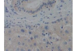 Detection of CENPH in Human Liver Tissue using Polyclonal Antibody to Centromere Protein H (CENPH) (CENPH antibody  (AA 1-247))
