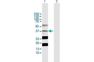 Western Blot analysis of STRADA expression in transfected 293T cell line by STRADA MaxPab polyclonal antibody. (STRADA antibody  (AA 1-348))