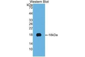 Detection of Recombinant KRT19, Human using Monoclonal Antibody to Cytokeratin 19 (CK19) (Cytokeratin 19 antibody  (AA 245-391))