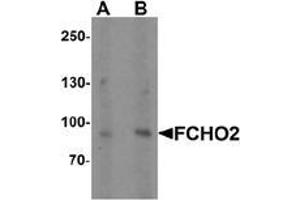 Western blot analysis of FCHO2 in rat heart tissue lysate with FCHO2 Antibody  at (A) 1 and (B) 2 µg/ml