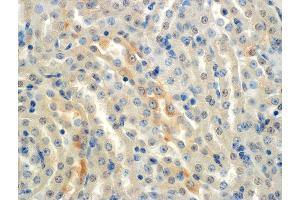 Immunohistochemistry analysis using Mouse Anti-ENaC alpha Monoclonal Antibody, Clone 2G4 . (SCNN1A antibody  (AA 46-68))