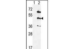 Western blot analysis of PK12 (arrow) using rabbit polyclonal hPK12- (ABIN391329 and ABIN2841359). (MAPK12 antibody  (AA 339-367))