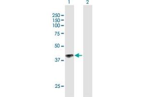 Western Blot analysis of IL12RB1 expression in transfected 293T cell line by IL12RB1 MaxPab polyclonal antibody. (IL12RB1 antibody  (AA 1-381))