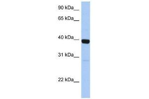 ZNF385B antibody used at 0. (ZNF385B antibody  (C-Term))