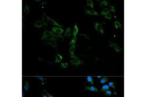 Immunofluorescence analysis of U2OS cells using MVP Polyclonal Antibody at dilution of 1:100. (MVP antibody)