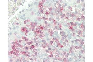Formalin-fixed and paraffin-embedded H.