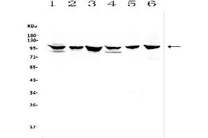 Western blot analysis of DDR1 using anti-DDR1 antibody (ABIN7601407). (DDR1 antibody  (AA 341-909))