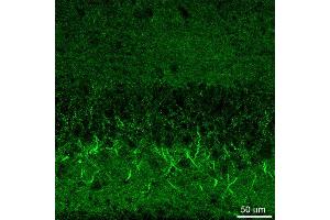 Indirect immunostaining of hippocampus neurons (dilution 1 : 500). (GABRB3 antibody  (AA 344-429))