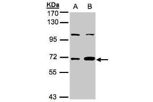 WB Image Sample(30 ug whole cell lysate) A:A431, B:MOLT4 , 7. (GBP1 antibody  (Internal Region))