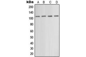 Western blot analysis of mGLUR5 expression in EOC20 (A), mouse liver (B), rat liver (C), rat brain (D) whole cell lysates. (Metabotropic Glutamate Receptor 5 antibody  (N-Term))