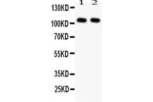 Anti- NFkB p105/p50 antibody, Western blottingAll lanes: Anti NFkB p105/p50 at 0. (NFKB1 antibody  (N-Term))