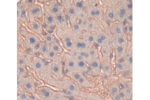 Used in DAB staining on fromalin fixed paraffin- embedded liver tissue (ABCG8 antibody  (AA 1-272))