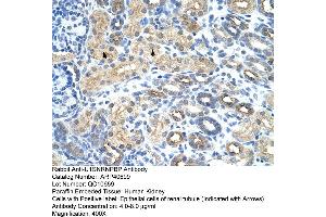 Rabbit Anti-U1SNRNPBP Antibody  Paraffin Embedded Tissue: Human Kidney Cellular Data: Epithelial cells of renal tubule Antibody Concentration: 4. (SNRNP35 antibody  (N-Term))