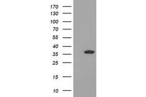HEK293T cells were transfected with the pCMV6-ENTRY control (Left lane) or pCMV6-ENTRY GRHPR (Right lane) cDNA for 48 hrs and lysed. (GRHPR antibody)