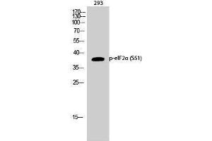 Western Blotting (WB) image for anti-Eukaryotic Translation Initiation Factor 2A, 65kDa (EIF2A) (pSer51) antibody (ABIN3181992) (EIF2A antibody  (pSer51))