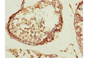 Immunohistochemistry of paraffin-embedded human testis tissue using ABIN7148059 at dilution of 1:100 (CCHCR1 antibody  (AA 483-782))