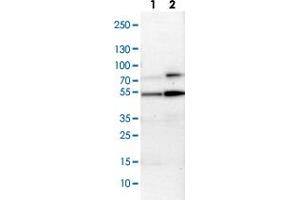Western Blot (Cell lysate) analysis with MAPKAPK5 polyclonal antibody  Lane 1: NIH-3T3 cell lysate (Mouse embryonic fibroblast cells) Lane 2: NBT-II cell lysate (Rat Wistar bladder tumour cells) (MAPKAP Kinase 5 antibody)