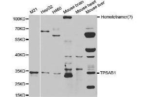 Western blot analysis of extracts of various cell lines, using TPSAB1 antibody. (TPSAB1 antibody  (AA 19-210))