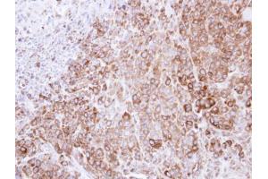 IHC-P Image Immunohistochemical analysis of paraffin-embedded SCM-1 xenograft , using HSP90B, antibody at 1:500 dilution. (GRP94 antibody  (Center))