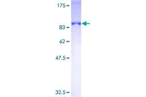OPTN Protein (AA 1-571) (GST tag)