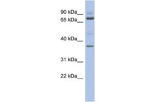 WB Suggested Anti-MTF2 Antibody Titration:  0. (MTF2 antibody  (Middle Region))