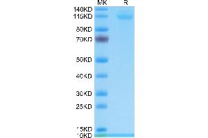 CD42b Protein (AA 17-531) (His tag)
