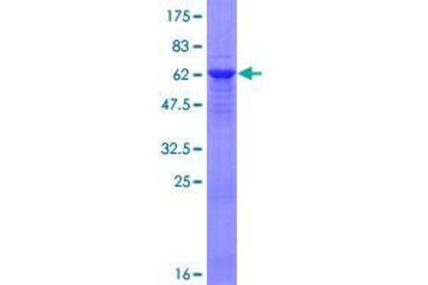 BRCC3 Protein (AA 1-316) (GST tag)
