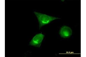 Immunofluorescence of purified MaxPab antibody to GOLGA2 on HeLa cell. (Golgin A2 (GOLGA2) (AA 1-345) antibody)