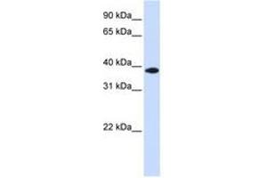 Image no. 1 for anti-Glycerol-3-Phosphate Dehydrogenase 1-Like (GPD1L) (C-Term) antibody (ABIN6741288) (GPD1L antibody  (C-Term))